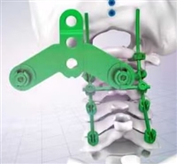 颈椎前路内固定系统郎和