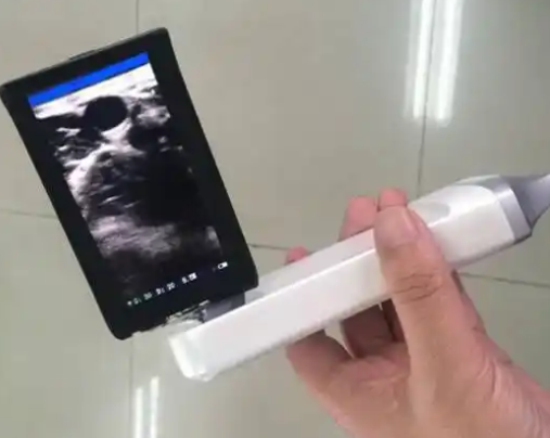 掌式超声显像仪D8d