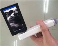 掌式超声显像仪D8d
