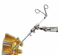 RESP-B、RESP-C椎间孔镜