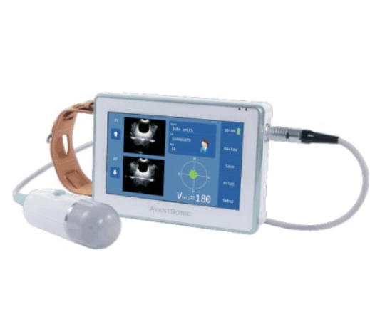 膀胱容量测定仪Z5康超