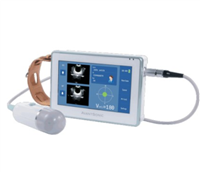 膀胱容量测定仪Z5康超