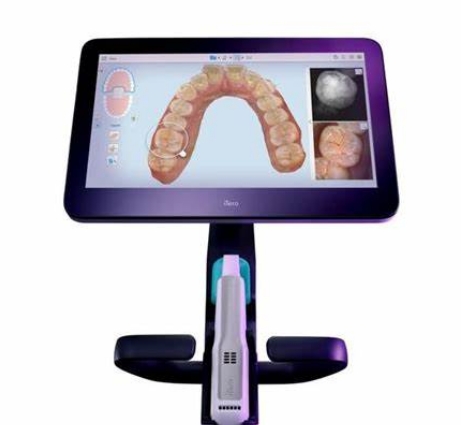 S300W口腔数字印模仪
