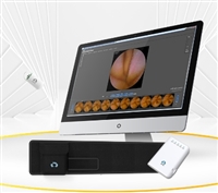 GICE-1000胃内窥镜系统