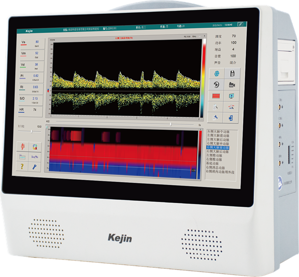 科进便携式经颅多普勒仪EXP-9系列