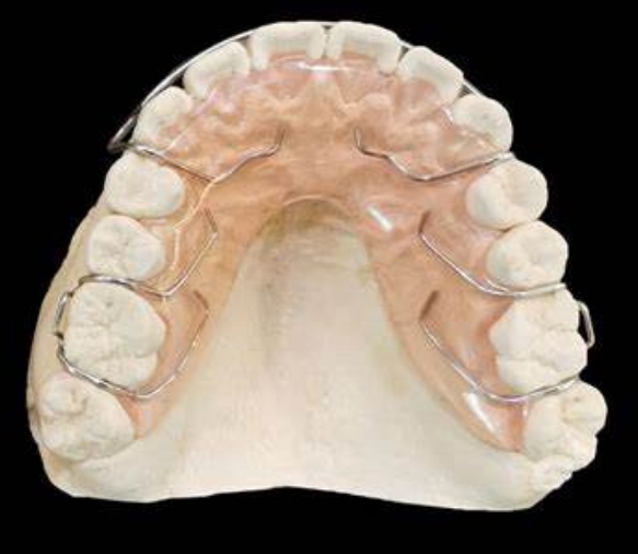 弹簧矫治器定制式活动矫治器