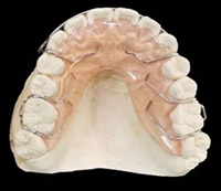弹簧矫治器定制式活动矫治器