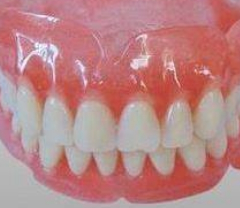 定制式活动义齿创适际