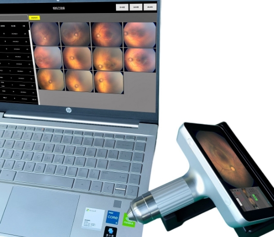 KRS-02眼科广域成像系统