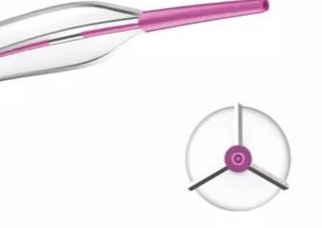 外周刻痕球囊扩张导管为泰