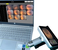 KRS-02眼科广域成像系统