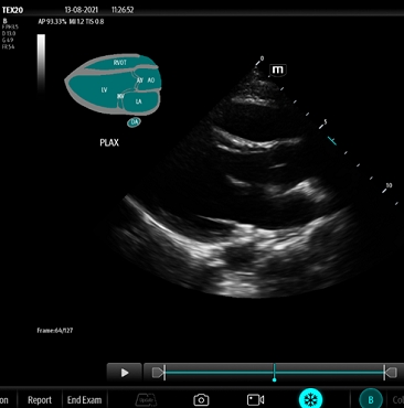 HEBIN-EchoPilot-E超声影像管理软件