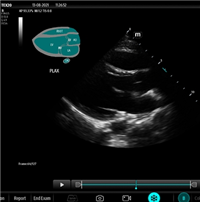 HEBIN-EchoPilot-E超声影像管理软件