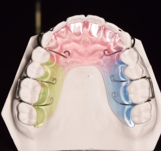 螺丝固定矫治器定制式正畸矫治器