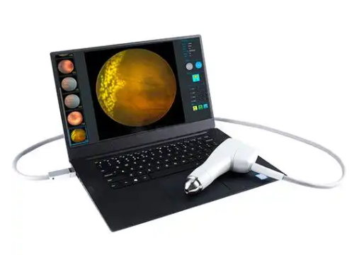 广域眼用造影仪DX108