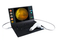 广域眼用造影仪DX108