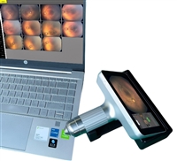 Kiretem-Mini眼科广域成像系统