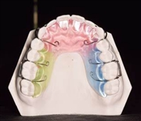 矫治保持型定制式矫治器