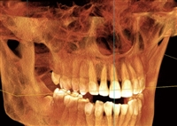 DC-PPF口腔X射线图像处理软件