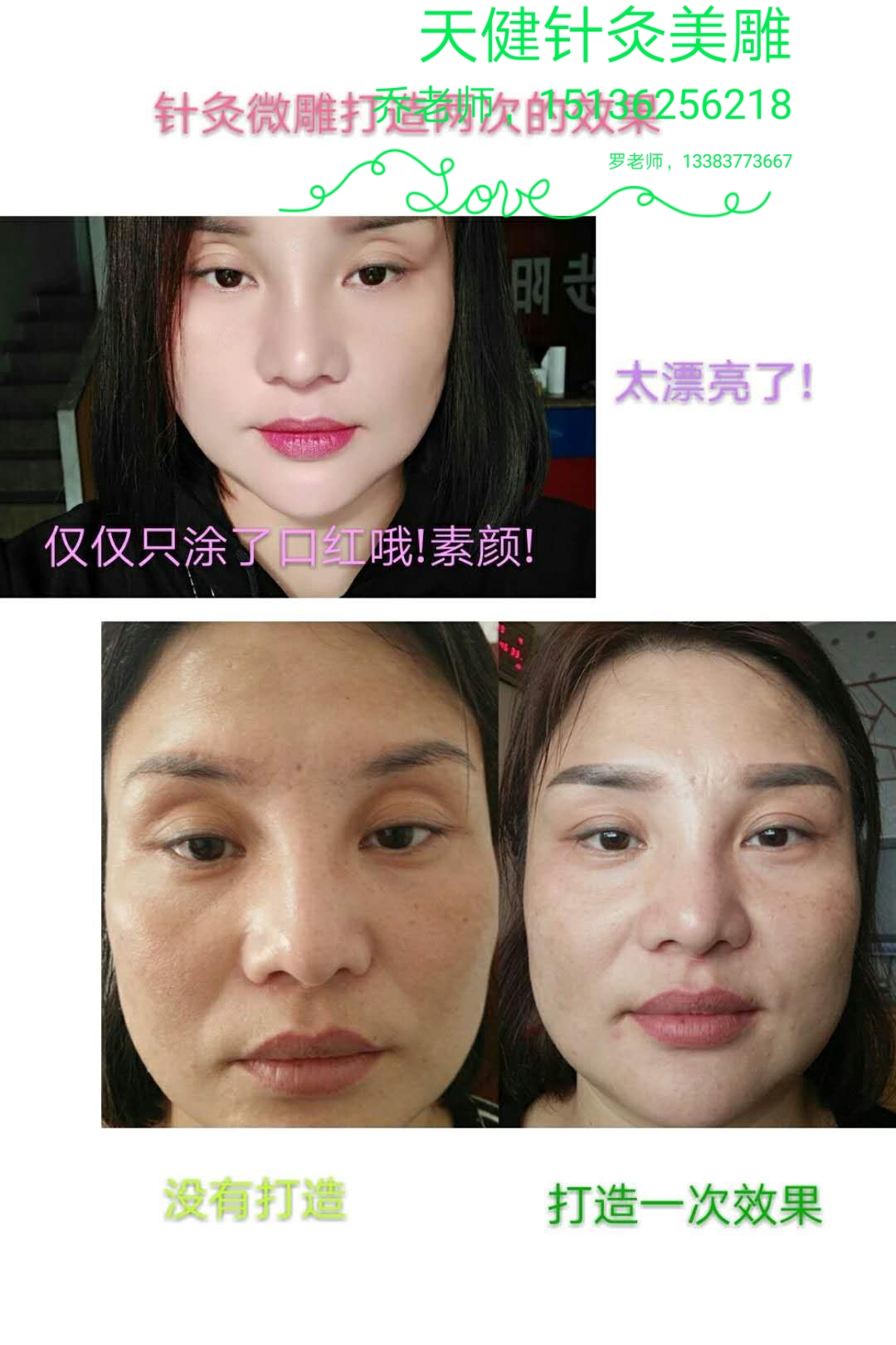 宣武区  寻梦缘中式美雕针灸美容  学费多少