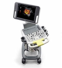 H70、H80掌上彩色多普勒超声系统