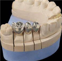 可加工玻璃陶瓷全瓷冠 定制式固定义齿