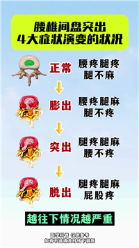 晋月堂膏贴-贴敷腰间盘突出效果好吗