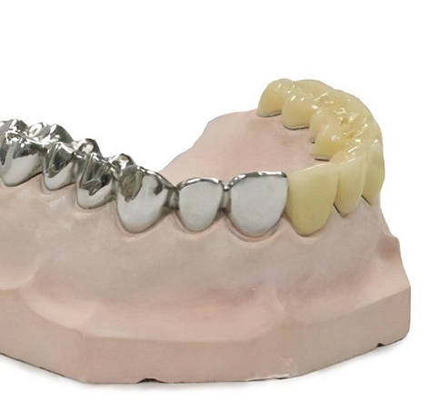 BF3D-DBFW-TM医用个性化骨科手术导板