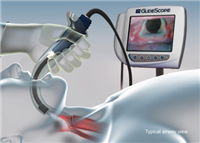 厂商美国GlideScope视频喉镜AVL Single-Use 可视视频喉镜系统