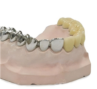 BF3D-DBFW-TM医用个性化骨科手术导板