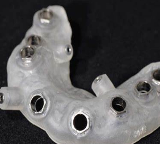 黏膜支持式定制式牙科种植用导板