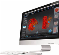 JZ-B600骨医学图像处理软件