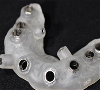 黏膜支持式定制式牙科种植用导板