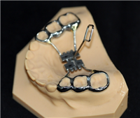 扩弓型、牙胶片型定制式矫治器