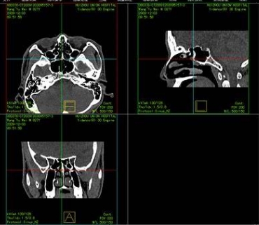 YL-001医学影像存储与传输软件