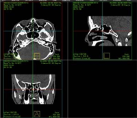 YL-001医学影像存储与传输软件