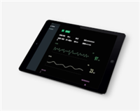 非接触式心率呼吸监测仪BA-CFPM-002