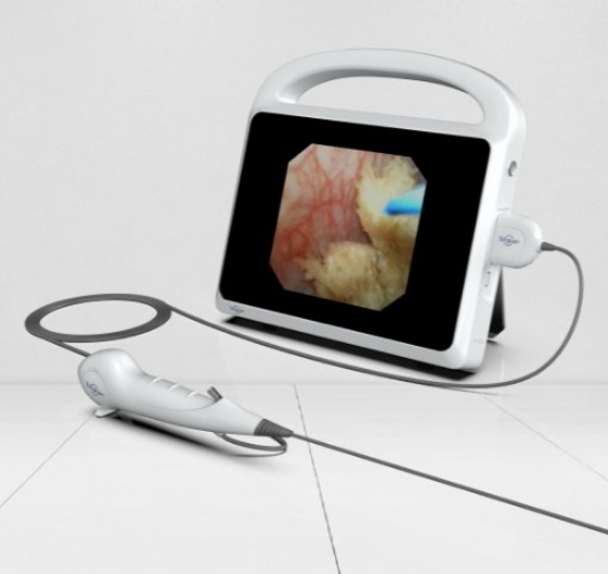 ICB-101电子内窥镜图像处理器