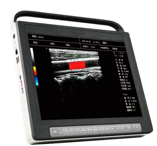 全数字彩色多普勒超声诊断仪ZY-6600