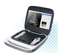 定量剪切波超声肝脏测量仪Liverscan Mobile