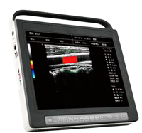 全数字彩色多普勒超声诊断仪ZY-6600