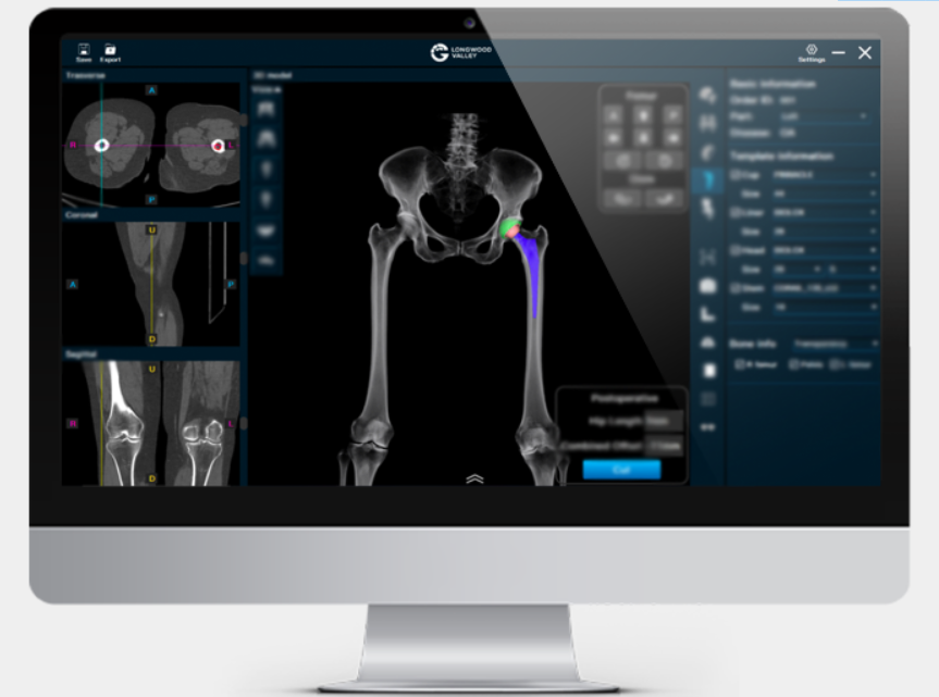 髋关节置换手术导航定位系统ROPAplasty-01
