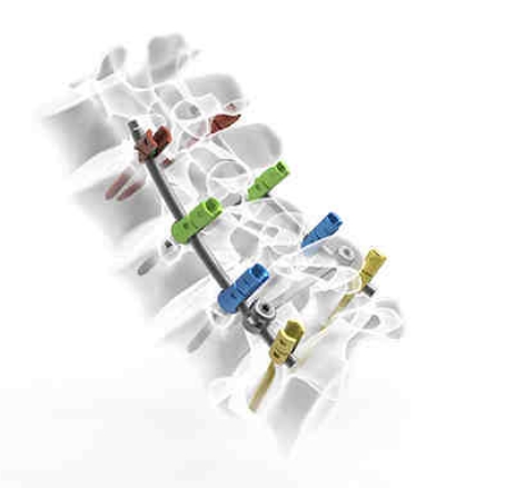 脊柱后路扩张通道组件创辰