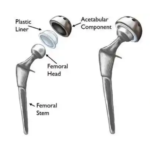 双动髋关节系统正天