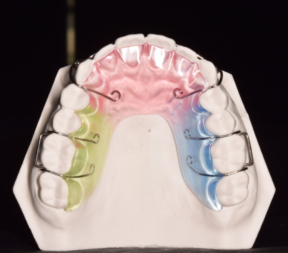 活动保持器定制式保持器
