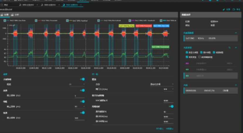 EMG肌电分析模块