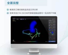 QAS-4C心脏量化分析系统