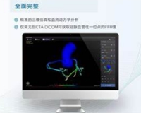 QAS-4C心脏量化分析系统