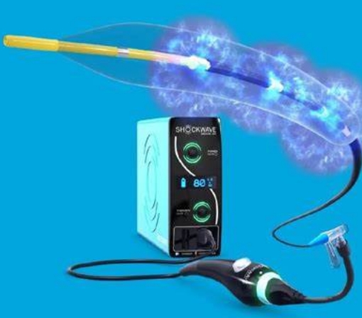 3.0*12一次性使用冠脉血管内冲击波导管