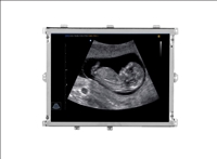 JGT185W30BN20-18.5寸FOB组装屏